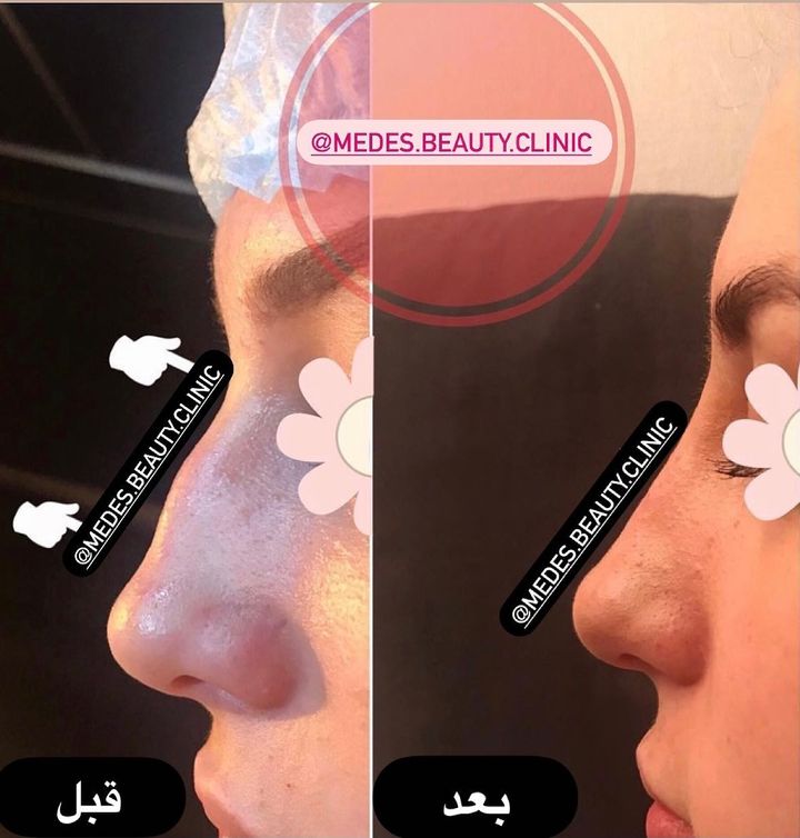 گالری اصلاح فرم بینی